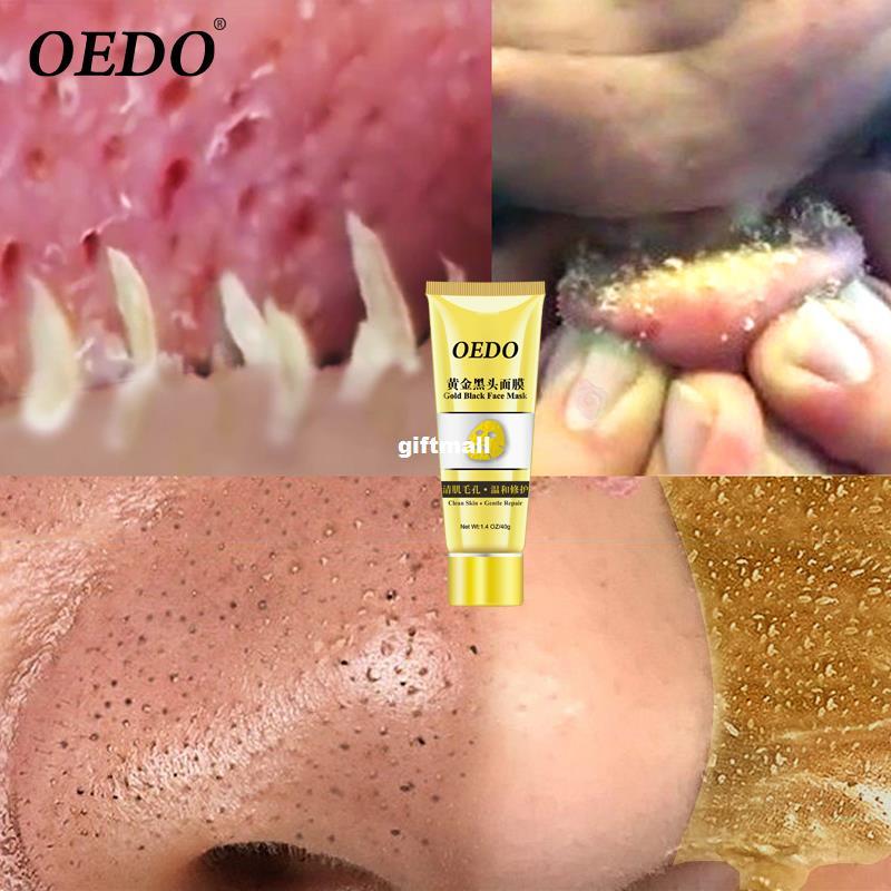 Blackhead Remover Gold Facial Mask