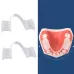 Y-Kelin Orthodontic Appliance Silicone Simulation Braces Anti-Molar Braces For Night Transparent