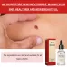Ximonth 20ml in Bottle Anti Mole And Wart Liquid Dark Spot Tag Remover Skin Essence