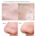Blackhead Electric Pore Removal Machine Clean Facial Equipment Without Base