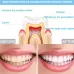 Wire-Controlled 25min Timing 16LED Teeth Whitening Device Dental Bleaching System White