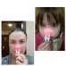 BIONASE Nose Care Therapy Machine Rhinitis Sinusitis Cure Hay Fever Treatment Machine