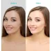 Xpreen XPRE061 Professional Dark Spot Remover Freckle Tattoo Chargeable Wart Mole Remover with LED Screen and Spotlight