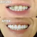 Silicone Whitening Simulation Braces Comfort Fit Flex Curved Teeth Dentures Beauty Tools 7cm